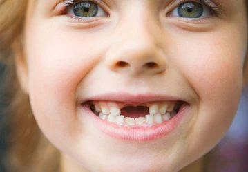 FAQ: Why are baby teeth important?